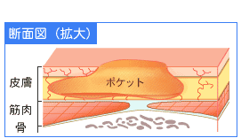 断面図